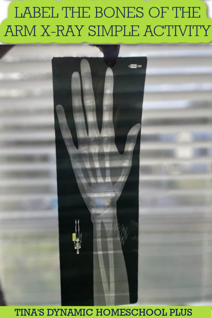 Label the Bones of the Arm X-Ray Simple Activity